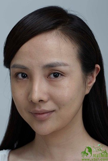 额头粗怎么办 201451285442467.jpg