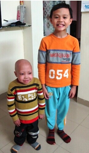 全球十大恐怖怪病-诡异恐怖-玉环纵纵横-三支脚